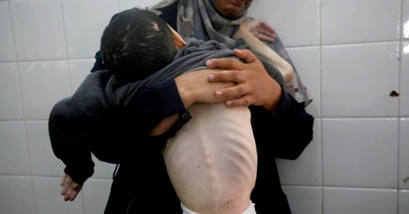 İsrail soykırımı tarafından dayatılan Gazze'de 4 kişi açlıktan öldü