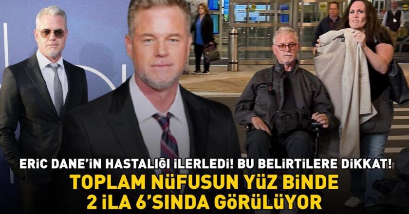 Euphoria'nın yıldızı Eric Dane hastalığı ilerledi! Bu belirtilere dikkat edin! Toplam nüfusun 100 bin başına 2-6'da görülür